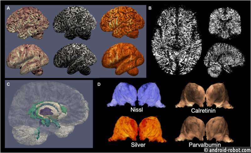 Ученые создают высокодетализированные 3D-реконструкции человеческого мозга