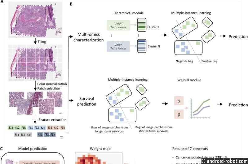 Инструмент ИИ прогнозирует выживаемость рака толстой кишки и ответ на лечение