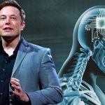 Neuralink получил разрешение на тестирование нейрочипов на людях